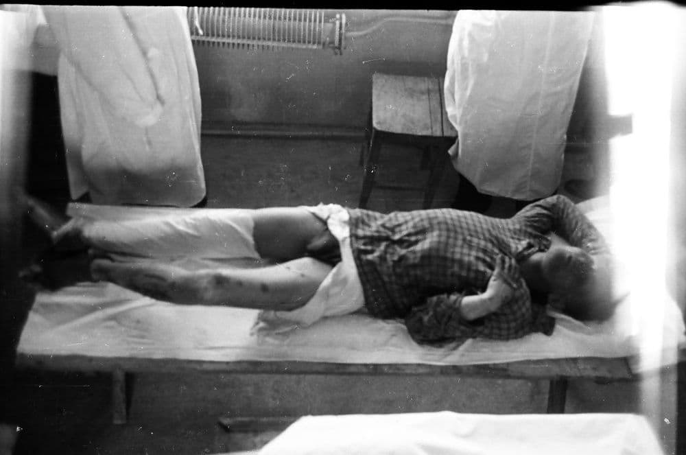 Telo Georgija Krivoniščenka, zdroj: dyatlovpass.com