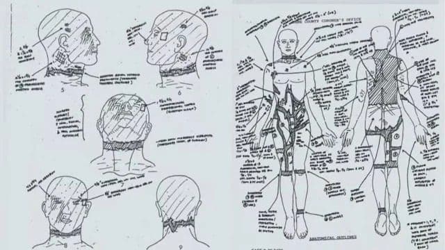 Nákres rozštvrtenia tela Shada Thyriona, zdroj: Inside Edition